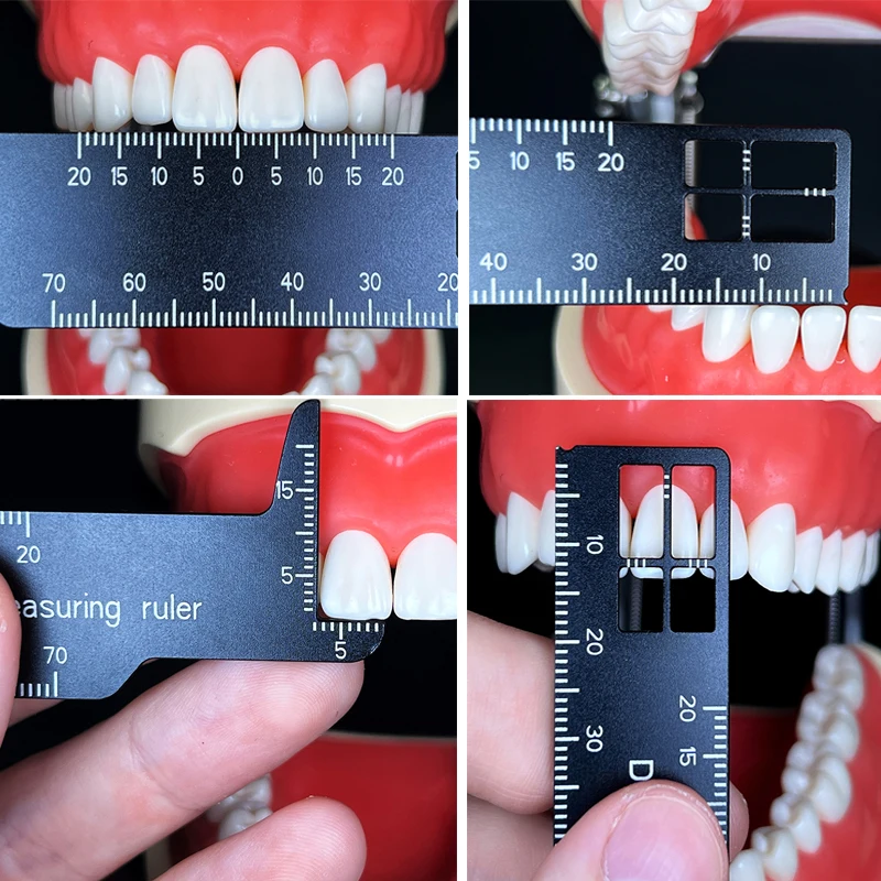 Photography Dental - Autoclavable Dental Precision Teeth Measuring Ruler