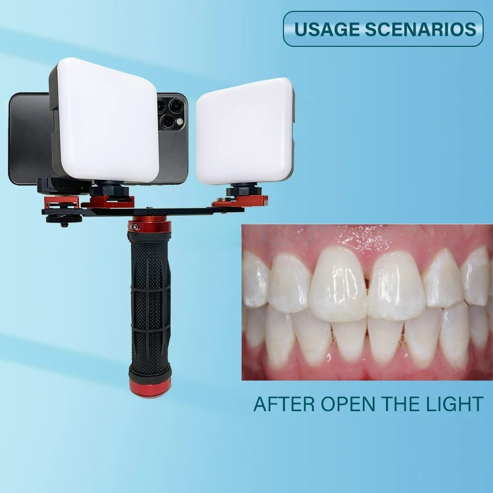 Dental Photography Light Phone - Photography Dental 评论和价格
