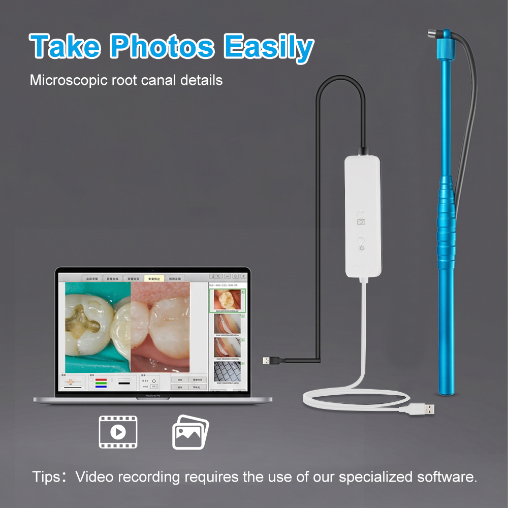 5MP Micro Intraoral Camera Den - Photography Dental 评论和价格