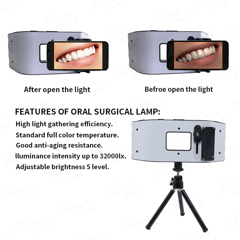 Dental Flash Light Photography - Photography Dental 评论和价格